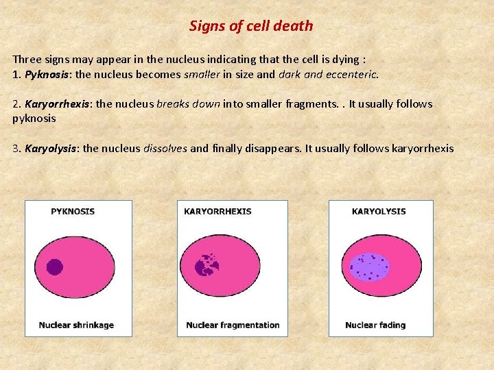 Signs of cell death Three signs may appear in the nucleus indicating that the