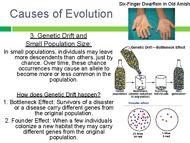 Six-Finger Dwarfism in Old Amish Causes of Evolution 3. Genetic Drift and Small Population