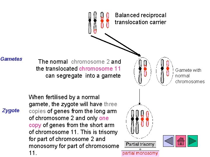 Balanced reciprocal translocation carrier Gametes Zygote The normal chromosome 2 and the translocated chromosome