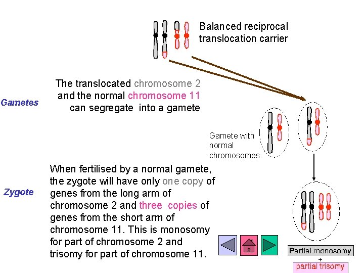 Balanced reciprocal translocation carrier Gametes The translocated chromosome 2 and the normal chromosome 11