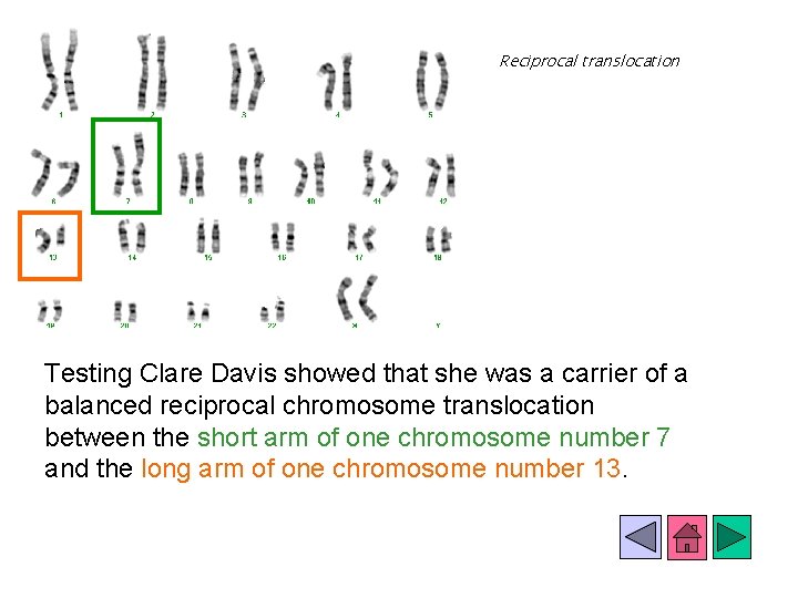 Reciprocal translocation Testing Clare Davis showed that she was a carrier of a balanced