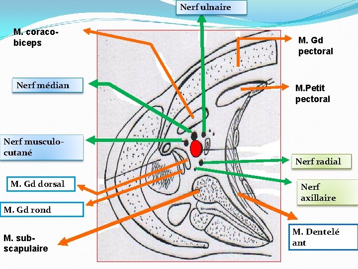 Nerf ulnaire M. coracobiceps Nerf médian Nerf musculocutané M. Gd dorsal M. Gd pectoral