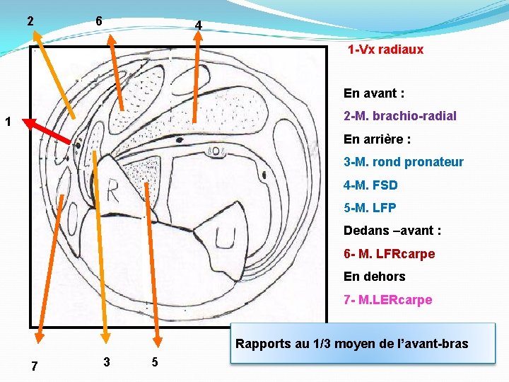2 6 4 1 -Vx radiaux En avant : 2 -M. brachio-radial 1 En