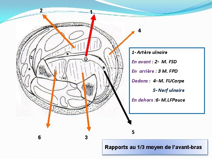 2 1 4 1 - Artère ulnaire En avant : 2 - M. FSD