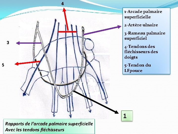 4 1 -Arcade palmaire superficielle 2 -Artère ulnaire 3 3 -Rameau palmaire superficiel 4