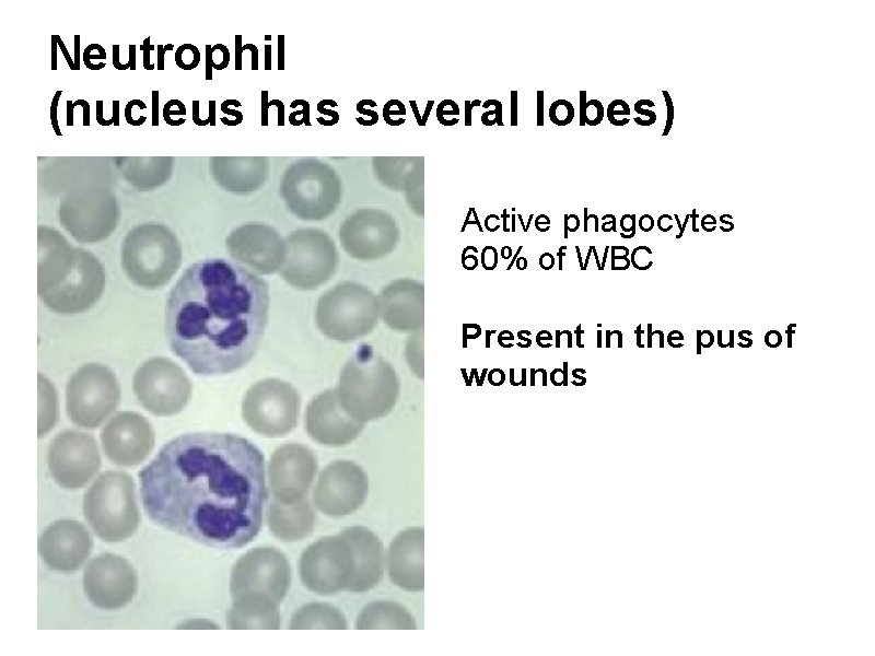 Neutrophil (nucleus has several lobes) Active phagocytes 60% of WBC Present in the pus