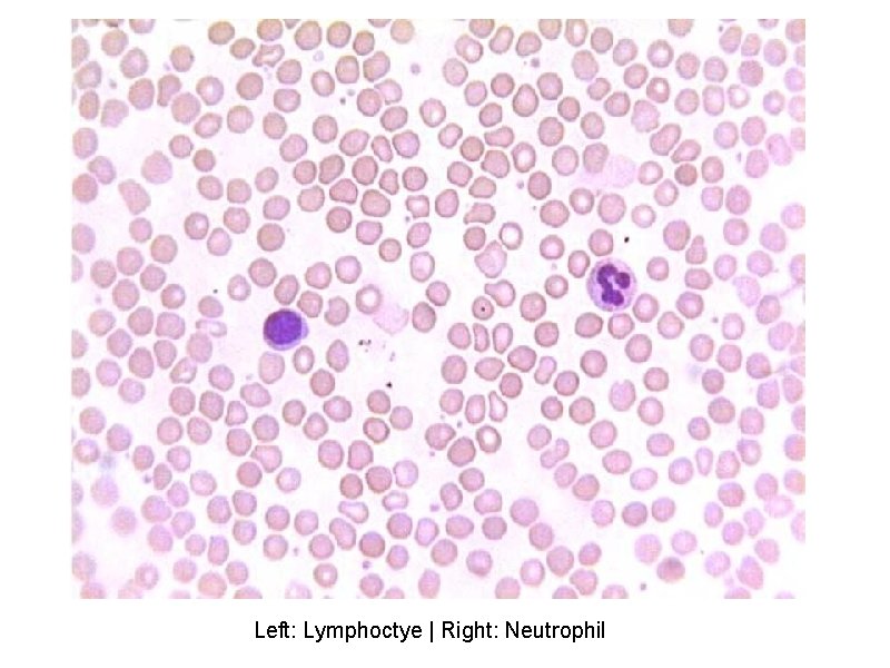 Left: Lymphoctye | Right: Neutrophil 