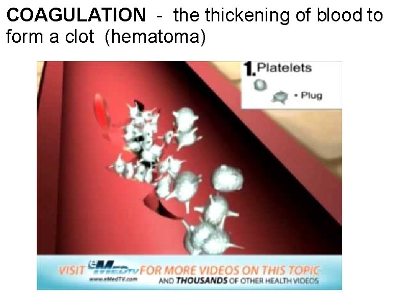 COAGULATION - the thickening of blood to form a clot (hematoma) 