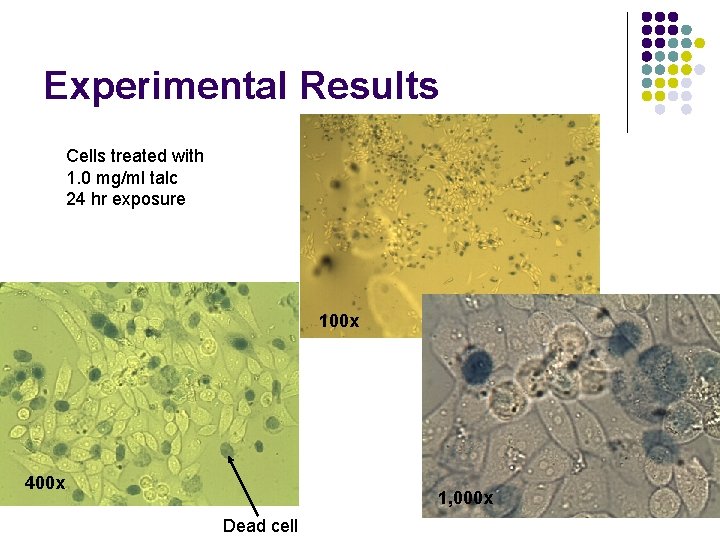 Experimental Results Cells treated with 1. 0 mg/ml talc 24 hr exposure 100 x
