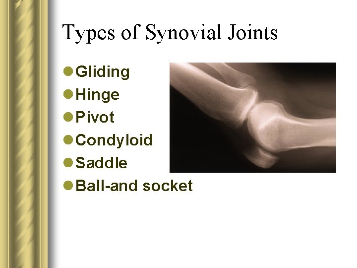 Types of Synovial Joints l Gliding l Hinge l Pivot l Condyloid l Saddle