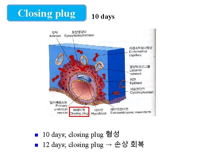 Closing plug 10 days; closing plug 형성 12 days; closing plug → 손상 회복