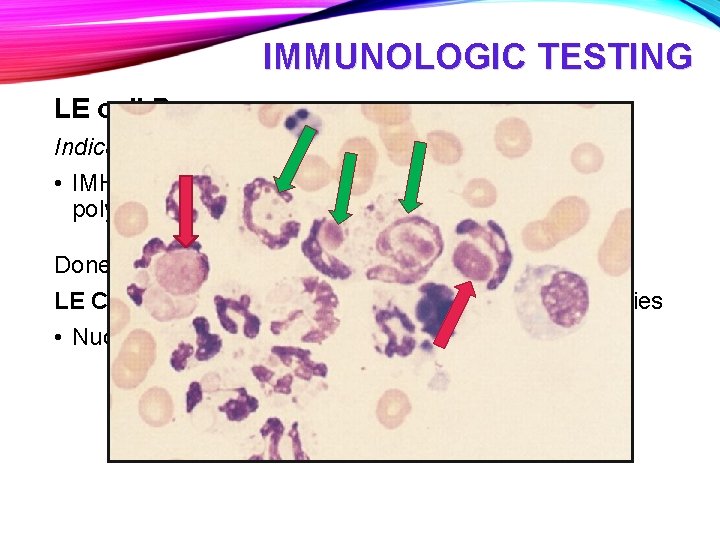 IMMUNOLOGIC TESTING LE cell Prep Indication: signs of SLE • IMHA, autoimmune skin disease,