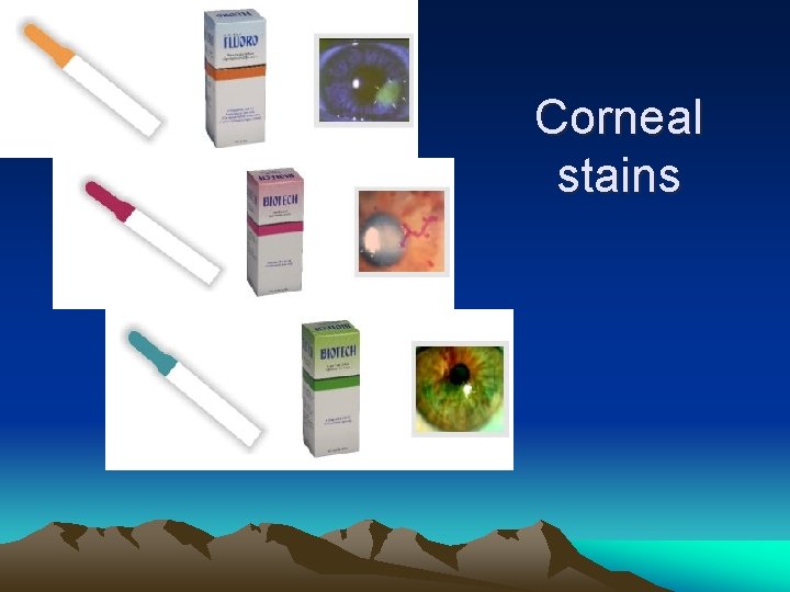 Corneal stains 