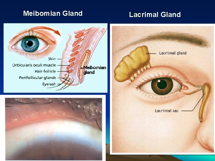 Meibomian Gland Lacrimal Gland 
