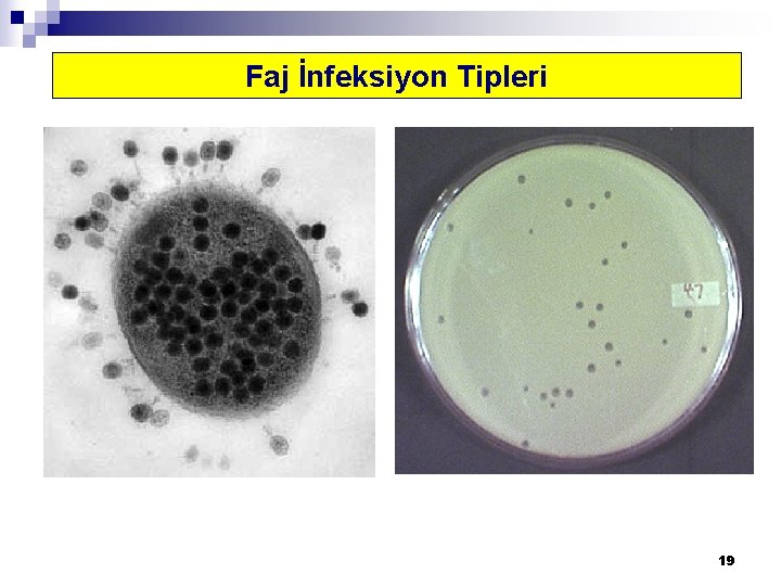 Faj İnfeksiyon Tipleri 19 