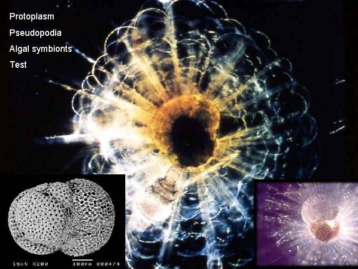 Protoplasm Pseudopodia Algal symbionts Test 