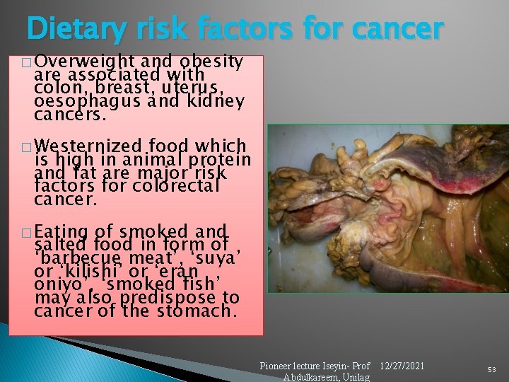 Dietary risk factors for cancer � Overweight and obesity are associated with colon, breast,