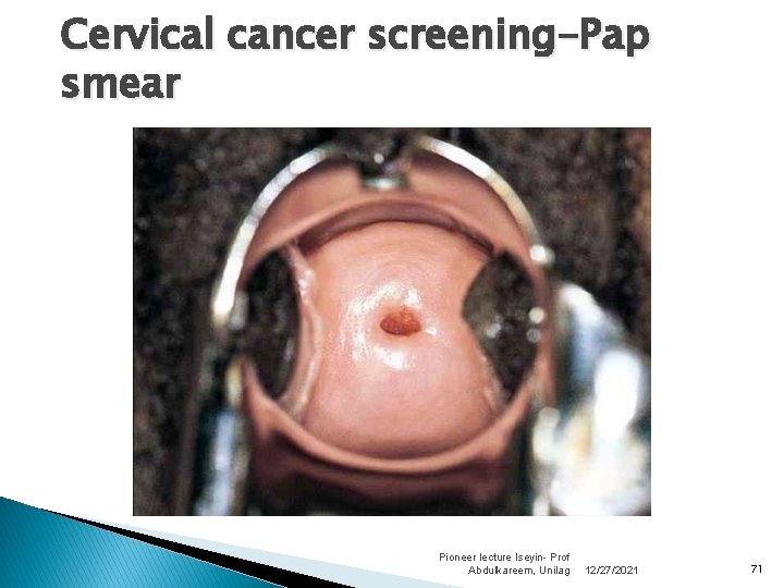 Cervical cancer screening-Pap smear Pioneer lecture Iseyin- Prof Abdulkareem, Unilag 12/27/2021 71 