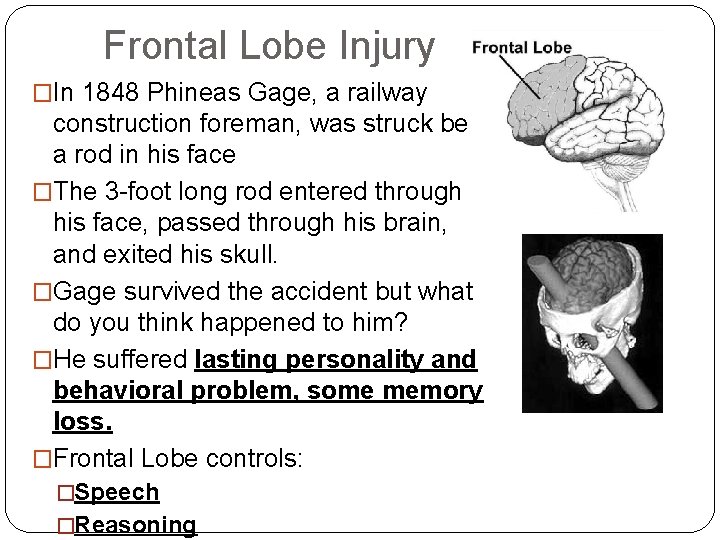 Frontal Lobe Injury �In 1848 Phineas Gage, a railway construction foreman, was struck be Frontal Lobe Injury �In 1848 Phineas Gage, a railway construction foreman, was struck be