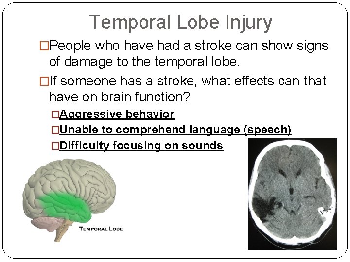 Temporal Lobe Injury �People who have had a stroke can show signs of damage Temporal Lobe Injury �People who have had a stroke can show signs of damage
