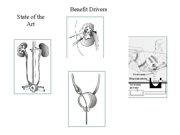 Benefit Drivers State of the Art 