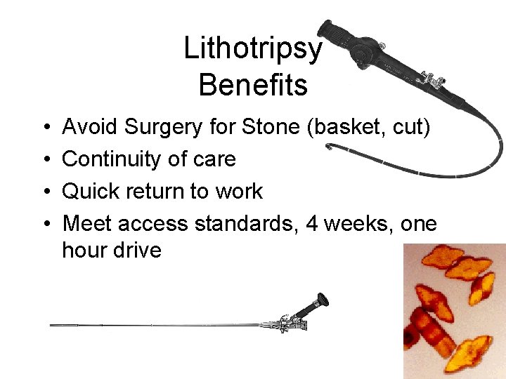 Lithotripsy Benefits • • Avoid Surgery for Stone (basket, cut) Continuity of care Quick