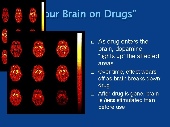 “Your Brain on Drugs” � � � As drug enters the brain, dopamine “lights