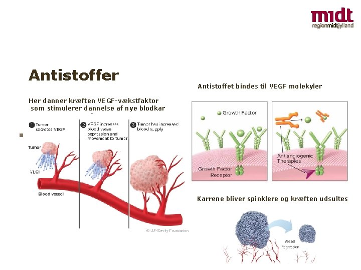 Antistoffer Antistoffet bindes til VEGF molekyler Her danner kræften VEGF-vækstfaktor som stimulerer dannelse af