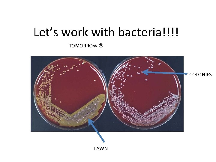 Let’s work with bacteria!!!! TOMORROW COLONIES LAWN 