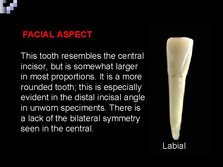 FACIAL ASPECT This tooth resembles the central incisor, but is somewhat larger in most