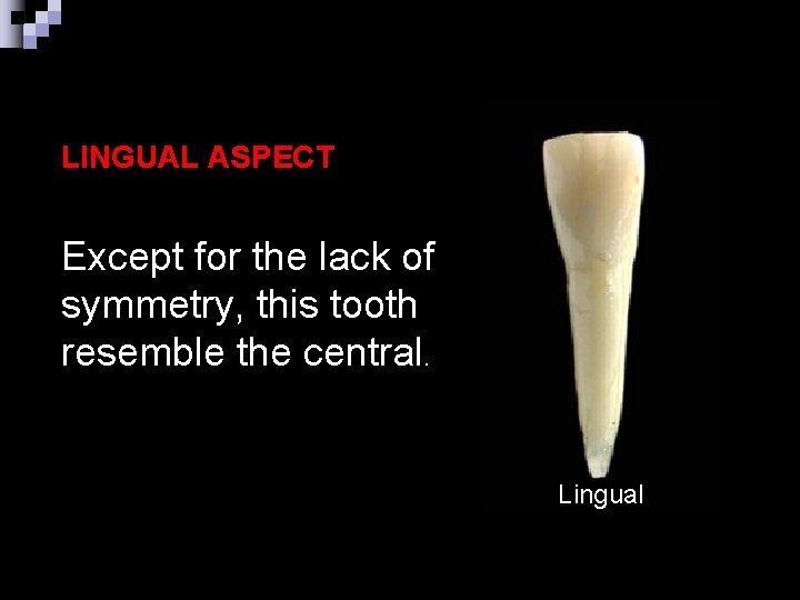 LINGUAL ASPECT Except for the lack of symmetry, this tooth resemble the central. Lingual