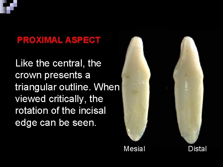 PROXIMAL ASPECT Like the central, the crown presents a triangular outline. When viewed critically,