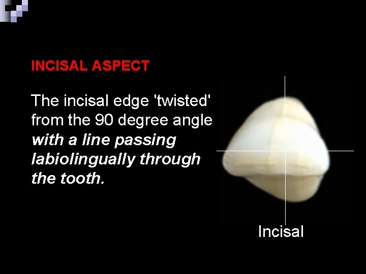 INCISAL ASPECT The incisal edge 'twisted' from the 90 degree angle with a line