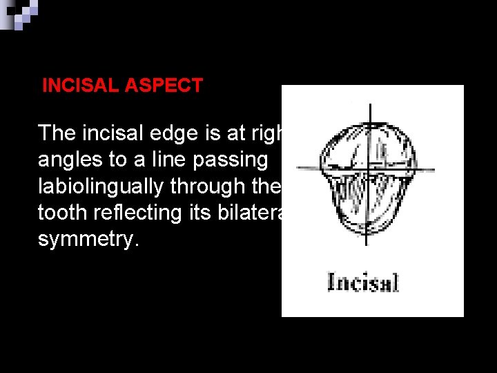 INCISAL ASPECT The incisal edge is at right angles to a line passing labiolingually