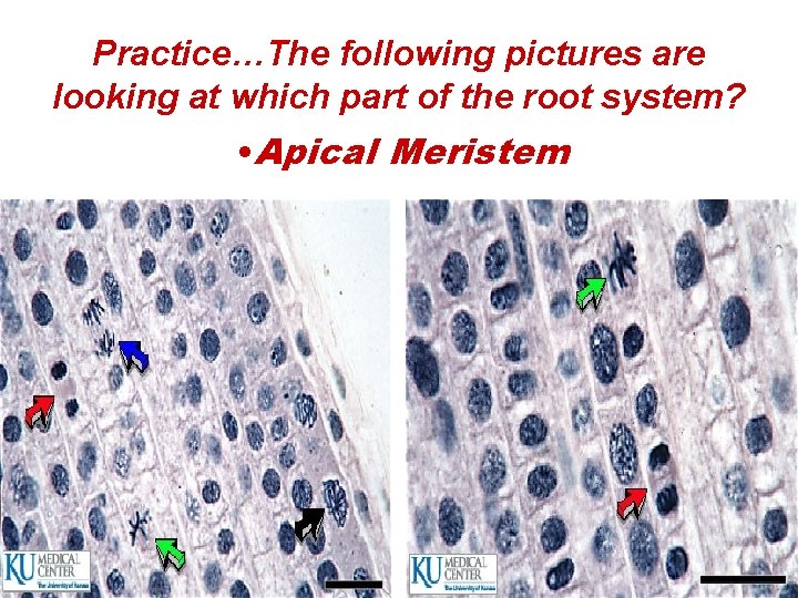 Practice…The following pictures are looking at which part of the root system? • Apical