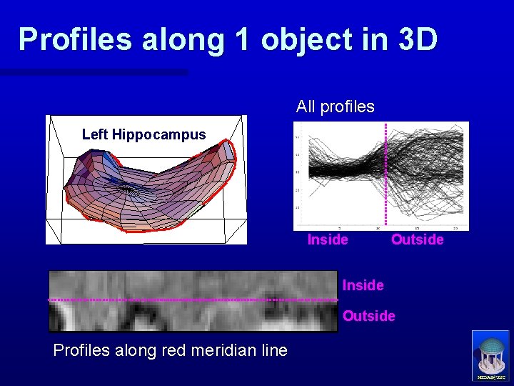 Profiles along 1 object in 3 D All profiles Left Hippocampus Inside Outside Profiles
