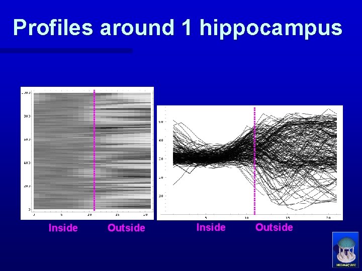 Profiles around 1 hippocampus Inside Outside 