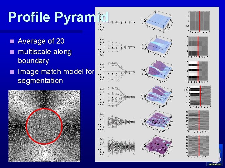 Profile Pyramid Average of 20 n multiscale along boundary n Image match model for