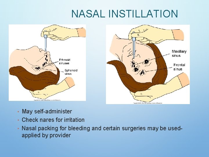 NASAL INSTILLATION • May self-administer • Check nares for irritation • Nasal packing for NASAL INSTILLATION • May self-administer • Check nares for irritation • Nasal packing for