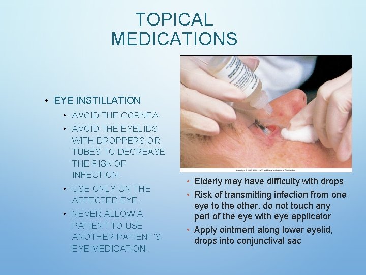 TOPICAL MEDICATIONS • EYE INSTILLATION • AVOID THE CORNEA. • AVOID THE EYELIDS WITH TOPICAL MEDICATIONS • EYE INSTILLATION • AVOID THE CORNEA. • AVOID THE EYELIDS WITH