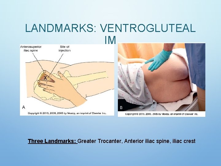 LANDMARKS: VENTROGLUTEAL IM Three Landmarks: Greater Trocanter, Anterior iliac spine, iliac crest LANDMARKS: VENTROGLUTEAL IM Three Landmarks: Greater Trocanter, Anterior iliac spine, iliac crest