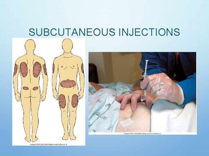 SUBCUTANEOUS INJECTIONS SUBCUTANEOUS INJECTIONS