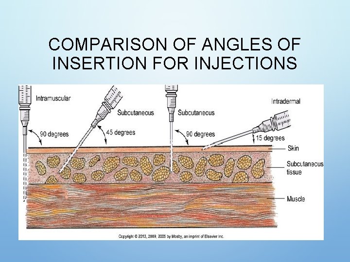 COMPARISON OF ANGLES OF INSERTION FOR INJECTIONS COMPARISON OF ANGLES OF INSERTION FOR INJECTIONS