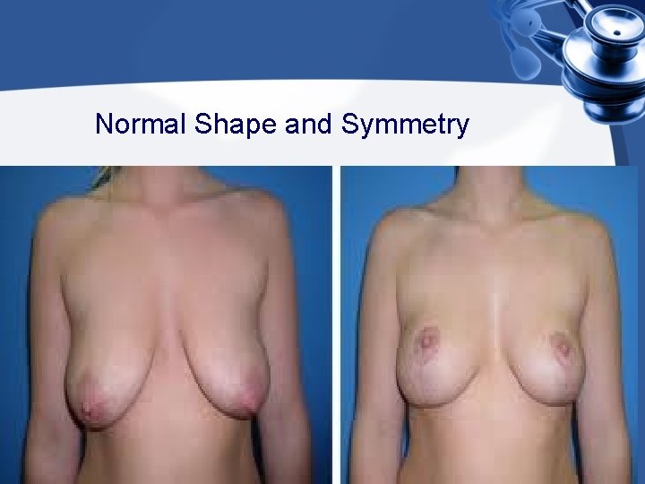 Normal Shape and Symmetry 