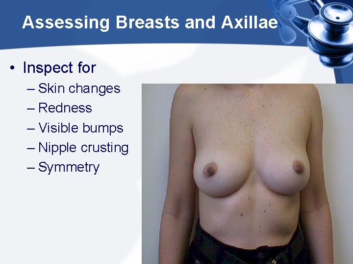 Assessing Breasts and Axillae • Inspect for – Skin changes – Redness – Visible