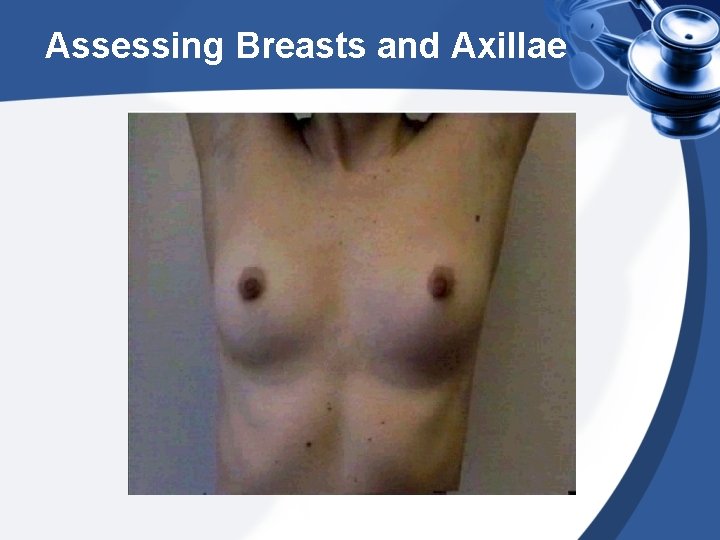 Assessing Breasts and Axillae 