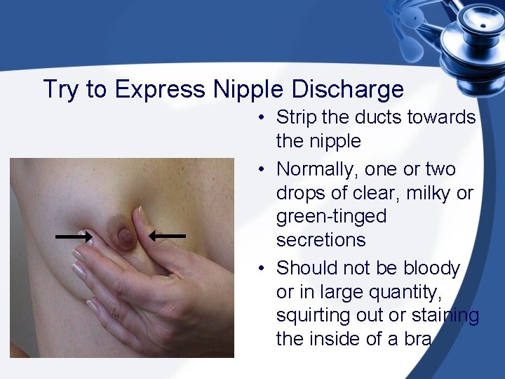 Try to Express Nipple Discharge • Strip the ducts towards the nipple • Normally,