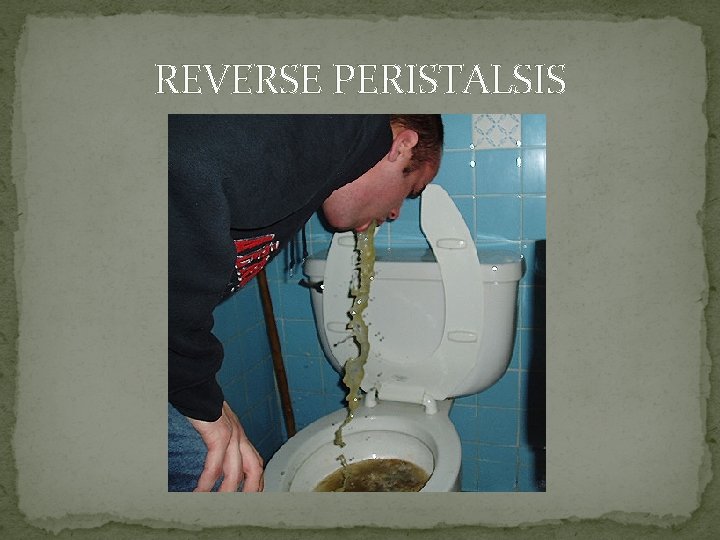 REVERSE PERISTALSIS 