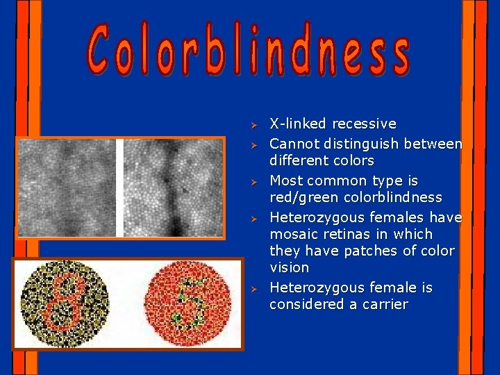 Ø Ø Ø X-linked recessive Cannot distinguish between different colors Most common type is