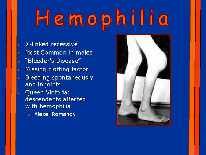 Ø Ø Ø X-linked recessive Most Common in males “Bleeder’s Disease” Missing clotting factor